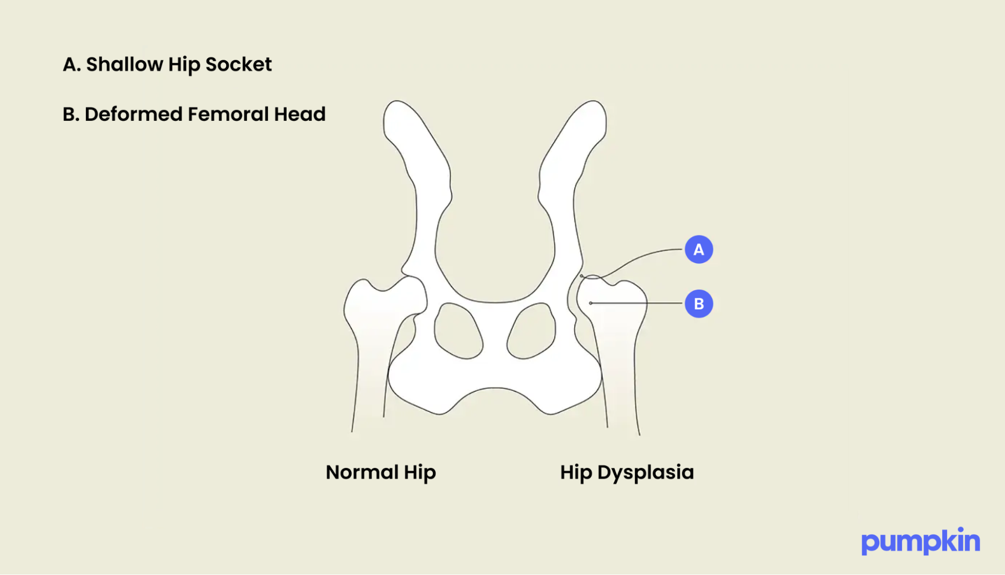 infographic showing the anatomy of a dog's hip and an example of canine hip dysplasia; highlights show a shallow hip socket and a deformed femoral head